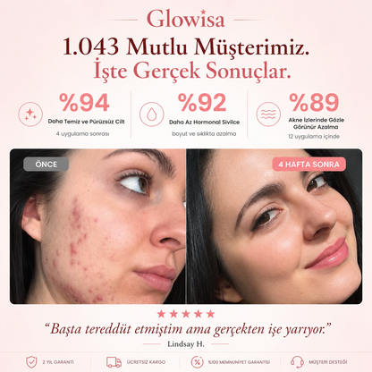 GLOWİSA Yüksek Frekans Çubuğu