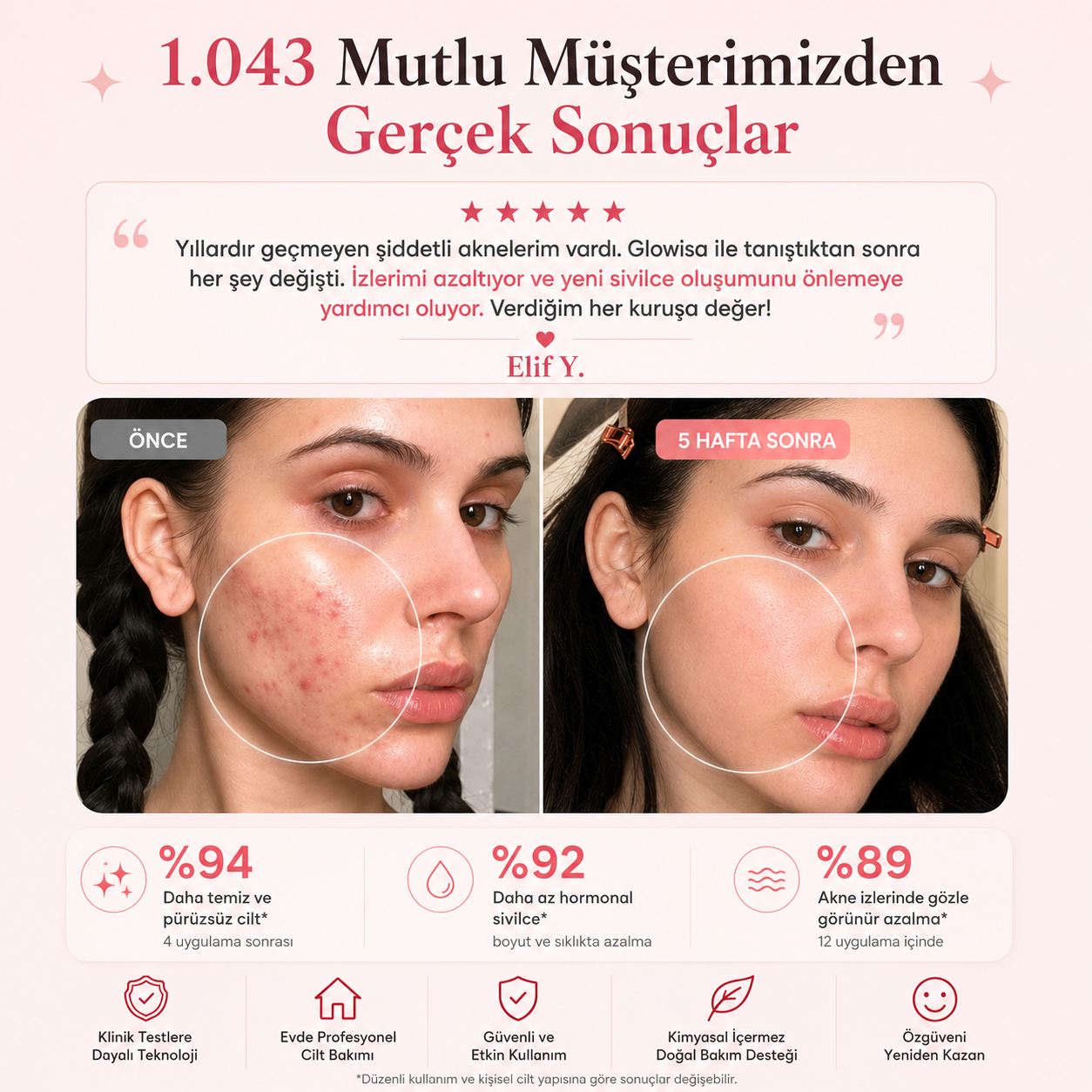 GLOWİSA Yüksek Frekans Çubuğu