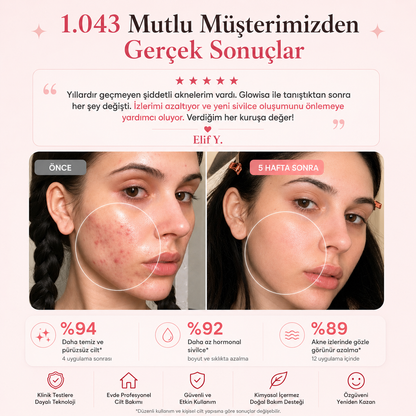 GLOWİSA Yüksek Frekans Çubuğu